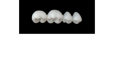 Cod.S3LOWER LEFT : 15x  posterior solid (not hollow) wax bridges, SMALL, (37-34) , with precarved occlusion to Cod.S3UPPER LEFT,and compatible to Cod.E3LOWER LEFT (hollow), (37-34)